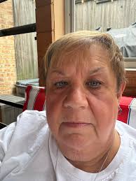 Hip Replacement Recovery and Support in Oregon