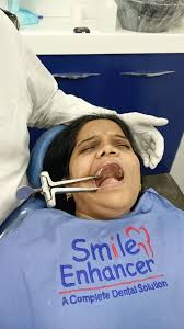 #mouthopener#trismusdental #dentistry #dental