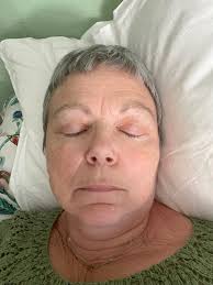 Noe helt spesielt har skjedd i ME-miljøet i New Zealand