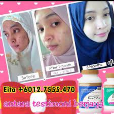The purity of shaklee vitamins and other products is obtained by periodic research. Testimoni Vitamin C Shaklee Serta Harga Vitamin C Shaklee