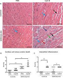 A substance made by the liver in response to inflammation inflammation is part of the body's natural defense mechanism in response to injury, infection, or. Plos One Sustained Toll Like Receptor 9 Activation Promotes Systemic And Cardiac Inflammation And Aggravates Diastolic Heart Failure In Serca2a Ko Mice
