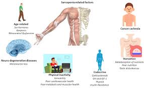 Image result for Cachexia in Cancer