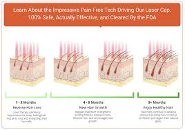 Much like plants draw their energy from the sun, the hair follicle (the pocket each hair grows out of) converts. Discover The Best Laser Caps Why The Right Number Of Diodes Is A Must