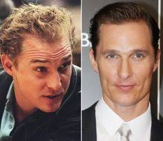 This is usually done to help the actor justify his roles in the films through his own looks. 16 Celebs Ideas Hair Transplant Celebrity Hairstyles Hair Loss