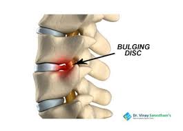 Pin On Dr Vinay Sarvotham