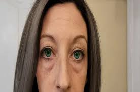 Denver Mayor Mike Johnston says "final good bye" to his mother, Sally  Johnston