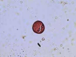 Image result for Stanfieldiella imperforata