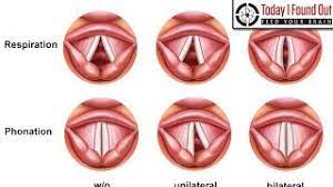 8 Reason Your Voice Cracks When You Sing | Vocal Health Explained -  Gemtracks Beats