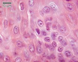 The following tests are used to identify merkel cell carcinoma, and to determine its stage (how far the disease has. Skin The Histology Guide
