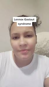 I have a rate type of epilepsy trying to reach out to others who go through  it #epilepsy #seizure #brain #LennoxGastautsyndrome#