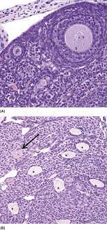 Direct labeling of the pe with vital dyes and retroviral lineage tracers in avian . Mesothelium An Overview Sciencedirect Topics