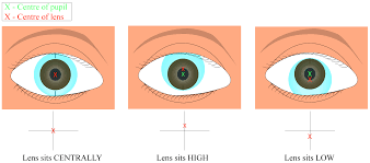 I think that must be something new under obamacare and a way for eye doctors to make extra money. Balancing Patient And Practitioner Goals In Contact Lens Fitting Contact Lenses Lens Fittings