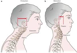 Explore more like neck flexion vs extension. Covid 19 A Pain In The Neck Tips For How To Manage Your Headaches Neck And Shoulder Pain Physio