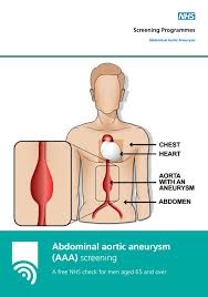 Abdominal Aortic Aneurysm Aaa Screening Programme An Important Milestone Public Health Matters Home diagnostic testing for aneurysm.