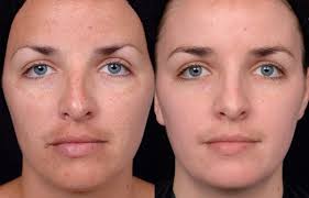 Laser treatments, slimming packages, cavitation, facials, solarium, nail bar, lash bar, fat freezing, solarium, tanning, botox, . Chic Med Aesthetic Clinics In Luqa Malta Read 5 Reviews