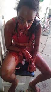 The site contains some of the really disturbing content, if you are not 18+ then please avoid this site. Bombshellsandbirds Documenting Reality Com Boyfriend Claims He Accidentally Shot Her In Head With A Shotgun Know Your Meme Is A Website Dedicated To Documenting Internet