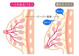 垂れた胸はもとに戻らない？胸が垂れる原因とバストアップにおすすめの「ヨガポーズ」 | ヨガジャーナルオンライン