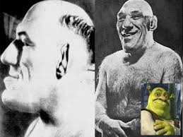 Maurice Tillet The Real Life Shrek Anatomy Class History Old Pictures