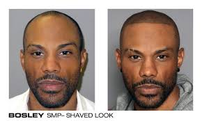 Bosley's hair regrowth treatment for men is clinically proven to regrow hair and slow down further hair loss. Bosley Hair Transplant Restoration 676 N Michigan Ave Chicago Il Hair Replacement Mapquest