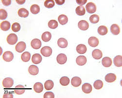 Image result for Red Blood Cell