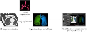 In some cases, however, the causes remain unknown. Software Based Quantitative Analysis Of Lung Parenchyma In Patients With Systemic Sclerosis May Provide New Generation Data For Pulmonary Fibrosis Temiz Karadag 2021 International Journal Of Clinical Practice Wiley Online Library