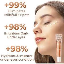 Silmänympärysvoide poistaa maitopisteitä, kiinteyttävä ryppyjä kirkastava  silmänympärysvoide tummille silmänalusille, vähentää