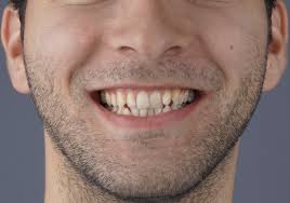 Uzm. Dt. Halil Toros Bingöl...