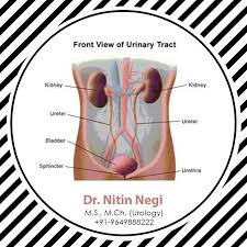 Pin On Urology