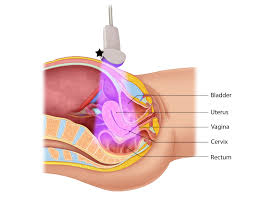 Female reproductive system with labels anatomy. Sonoguide Early Pregnancy