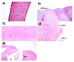 Discovered by ᴠ ɪ ᴄ ᴛ ᴏ ʀ ɪ ᴀ. Biomolecules Free Full Text Col2a1 And Caspase 3 As Promising Biomarkers For Osteoarthritis Prognosis In An Equus Asinus Model Html