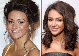 Last year the tv star played erin in sky one's brassic (image: Michelle Keegan Plastic Surgery Before And After Doctor Comments On Soap Star S Face Kylie Jenner Plastic Surgery Plastic Surgery Celebrity Plastic Surgery