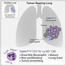 Many will live for months and even years longer than this. Tumor Promoting Ly 6g Siglecfhigh Cells Are Mature And Long Lived Neutrophils Sciencedirect
