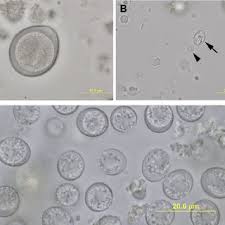 Antibiotics should take care of the coccidia. Coccidial Oocysts From Cat Feces A Unsporulated Oocysts Of Download Scientific Diagram