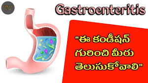 Szajewska h., dziechciarz p., mrukowicz j. Information About Gastroenteritis Definition Symptoms Treatment Precautions Bright Star Youtube