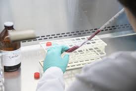 Anticuerpos es un proyecto documental danzado donde a través de la expresión. Ya Te Puedes Hacer Una Prueba De Anticuerpos Contra Coronavirus En La Ua Vida Y Familia Tucson Com