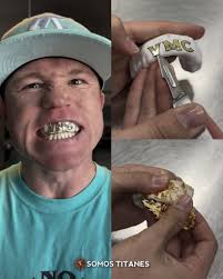 EL PROTECTOR MAS CARO DE LA HISTORIA!!🇲🇽💵🌟 Saúl el "Canelo" Alvarez  utilizó el protector más caro de la historia en la pelea contra Berlanga,  el cual incluía oro real. LOS LUJOS DEL