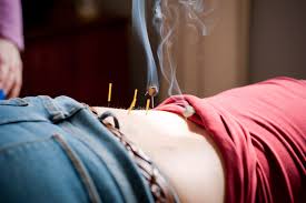 Does blue cross blue shield massachusetts cover acupuncture. Medicare Now Covers Acupuncture The Martha S Vineyard Times