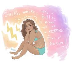 Lightning Bolts By Peyjune Stretch Marks Quotes Body Positivity Loving Your Body