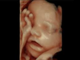 3d baby ultraschall in verschiedenen schwangerschaftswochen. Pranatale Diagnostik Berlin Lichtenberg