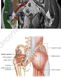 Jun 15, 2021 · muscles used in the hex bar deadlift diagram one of the main muscle groups engaged in the hex bar deadlift is the erector spinae muscles. 3 Mri Coronal Images Showing Gluteal Muscles And Nerves Ac Alcock S Download Scientific Diagram