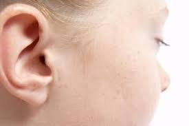 Natural Remedies For Ear Wax Removal In Children Modernmom Ear Wax Removal Natural Ear Wax Removal Ear Wax Buildup