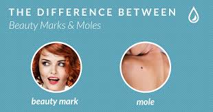 He has a beauty mark below his lip on the left side of his face. How To Tell The Difference Between A Mole And A Freckle The Dermatology Specialists