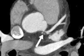 We have strict sourcing guidelines and only link to reputable media sites, academic research institutions and, whenever possible, medically peer reviewed studies. Radiologie In Der Herzdiagnostik Raus Aus Den Kinderschuhen Management Krankenhaus
