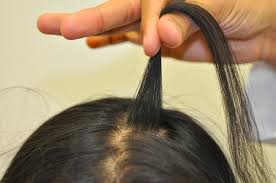 Image result for Hair Pull Test