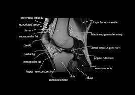 This section of the website will explain large and minute details of sagittal knee cross sectional anatomy. Mri Knee Anatomy Knee Sagittal Anatomy Free Cross Sectional Anatomy