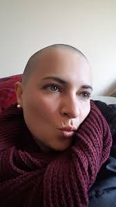 A atriz teve câncer no ovário e a combatia desde 2010. Careca Blog Quimioterapia E Beleza
