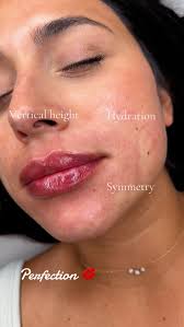 𝑷𝒆𝒓𝒇𝒆𝒄𝒕𝒊𝒐𝒏 😍✨, 1ml $700💕, Mayra Gamboa BSN , RN ✨, To book call 