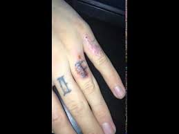 Hi guys today i'm talking how to remove a tattoo at home with salt ? Tattoo Removal Which Salt Result Youtube