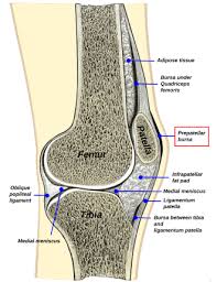 Image result for Prepatellar Bursa Injection