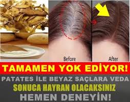 Sevilen Hikayeler Sadece Patates Kullanarak Olusan Beyaz Saclardan Kurtulun Kesin Cozum Beyaz Sac Sac Dogal Sac Bakimi